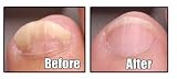 31yOzhBNrIL. SL160  Buy Gel Nails