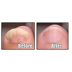 NonyX Nail Gel