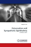 Evisceration and Sympathetic Ophthalmia: Is there a risk?