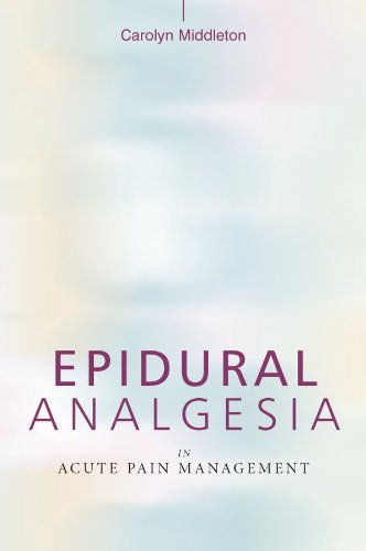 Epidural Analgesia in Acute Pain Management (Middleton, Epidural Analgesia in Acute Pain Management)