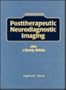 Posttherapeutic Neurodiagnostic Imaging