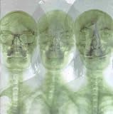 Supergrass