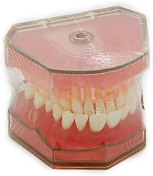 Lanjing® Dental Model #4004 01 - Standard Model with Removable Teeth