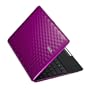 ASUS Eee PC 1008P-KR-PU17-PI 10.1-Inch Netbook (Hot Pink)