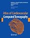 Books : Atlas of Cardiovascular Computed Tomography: includes narrated videos