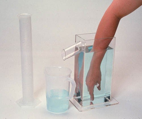 `Hand Volumetric Edema Evaluation Set