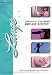 Stereotactic Core Needle Breast Biopsy [VHS]