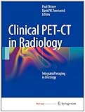 Infectious complications in bone marrow transplantation
