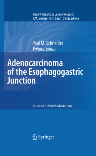 Adenocarcinoma of the Esophagogastric Junction: 182 (Recent Results in Cancer Research)
