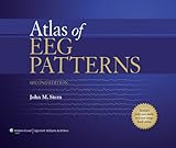 Atlas of EEG patterns