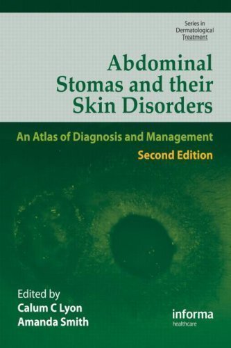 Abdominal Stomas and Their Skin Disorders,Second Edition (Series in Dermatological Treatment) 2nd (second) edition published by CRC Press (2009) Hardcover