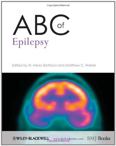 ABC of Epilepsy (ABC Series)