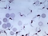 Trypanosomes Blood Smear Parasitic Infection Photographic Poster Print, 24x18