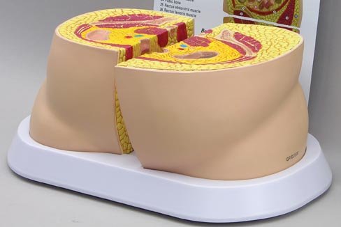 41%2BnHCMNSEL obesity: Obesity Anatomical Model
