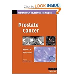Prostate Cancer (Contemporary Issues in Cancer Imaging)