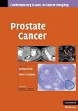 Prostate Cancer (Contemporary Issues in Cancer Imaging)