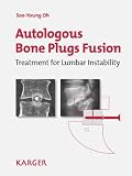 Autologous Bone Plugs Fusion: Treatment for Lumbar Instability: 3E Criteria/ Technical Operative Notes/ The Functioning of the Ohs Screw