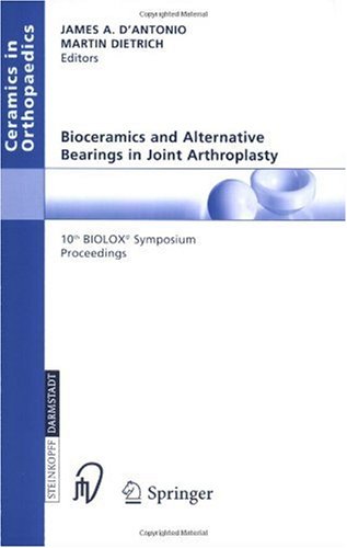 Arthroplasty