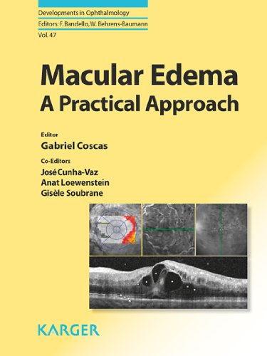 Macular Edema (Developments in Ophthalmology)