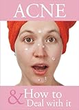 Acne and How to Deal With It