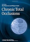 Chronic total occlusions : a guide to recanalization