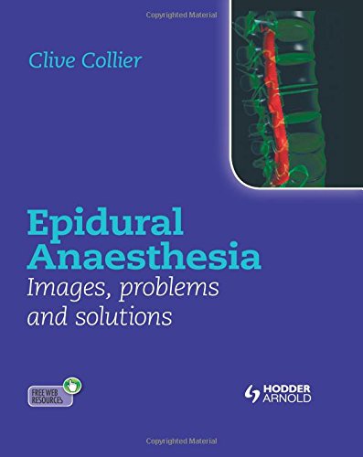 epidural anaesthesia images problems and solutions