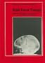 Brain Tumor Therapy (Progress in Experimental Tumor Research)