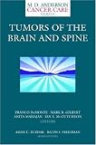 Tumors of the Brain and Spine (M.D. Anderson Cancer Care Series)