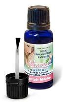 Stretch Marks Natural Treatment By Naturasil