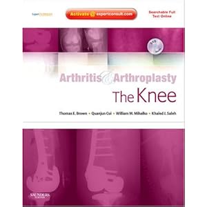 Arthritis and Arthroplasty: The Knee: Expert Consult - Online, Print and DVD