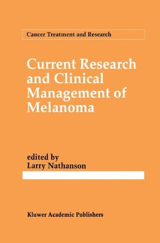 Current Research and Clinical Management of Melanoma (Cancer Treatment and Research)
