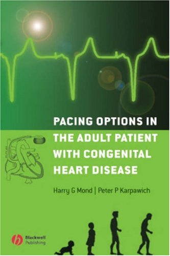 Congenital-Heart-Disease