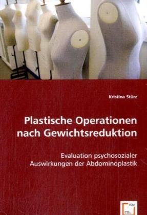 Abdominoplastik