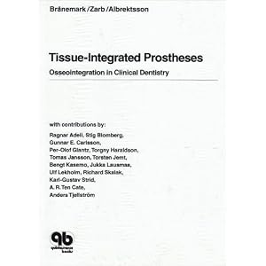 Click here to buy Tissue-Integrated Prostheses: Osseointegration in Clinical Dentistry by Per-Ingvar Branemark, George A. Zarb, and Tomas Albrektsson.