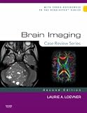 Brain Imaging: Case Review Series (Case Review)