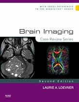 Brain Imaging: Case Review Series (Case Review)
