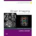 Brain Imaging: Case Review Series