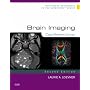 Brain Imaging: Case Review Series (Case Review)