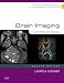 Brain Imaging: Case Review Series (Case Review)