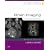 Brain Imaging: Case Review Series