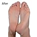Foot Pedicure Machine By JTrim FinePedi Micro Pedi Electric Callus Remover For Feet Care Foot File Shaver Tool Include Travel Case Ladies in Pink JPT-CR200 Jay's Products