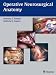 Book Operative Neurosurgical Anatomy