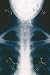 Art Poster, Infant Chest - 18.75 x 27.5