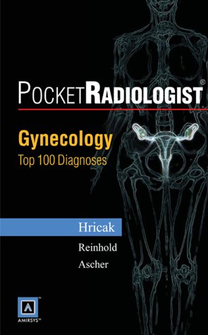 PocketRadiologist - Gynecologic: Top 100 Diagnoses