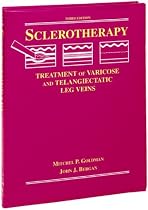 Sclerotherapy: Treatment of Varicose and Telangiectatic Leg Veins