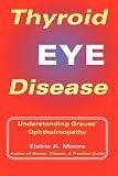 Thyroid Eye Disease: Understanding Graves' Ophthalmopathy