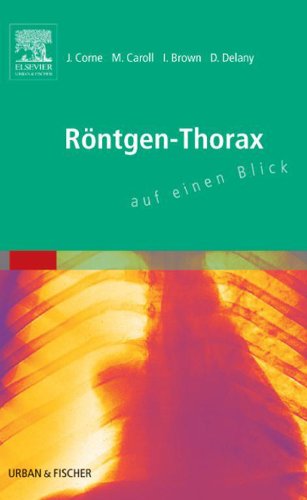 Röntgen-Thorax auf einen Blick (German Edition)
