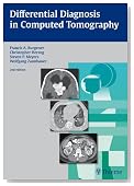 Differential Diagnosis in Computed Tomography