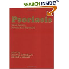 Psoriasis (Basic & Clinical Dermatology)