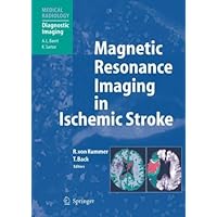 Magnetic Resonance Imaging in Ischemic Stroke (Medical Radiology / Diagnostic Imaging)